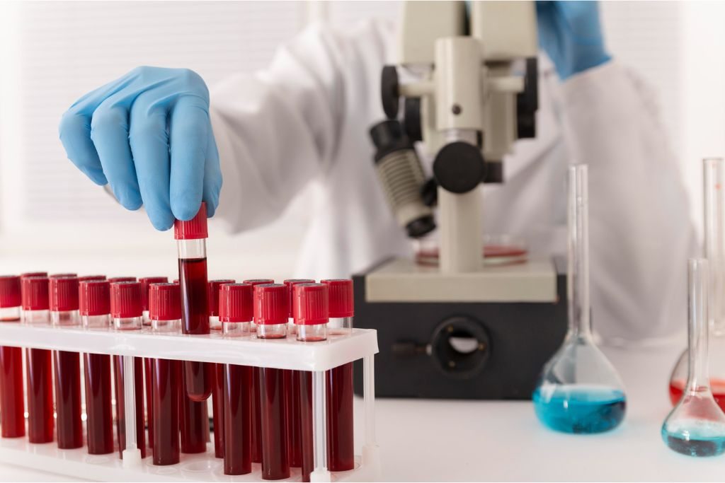 Blood sample tubes in a haematology laboratory